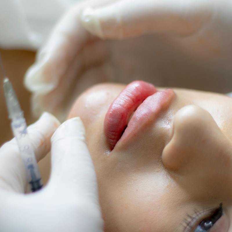 Woman about to receive skin booster and collagen stimulator treatment at Bespoke Medical Aesthetics in Colchester