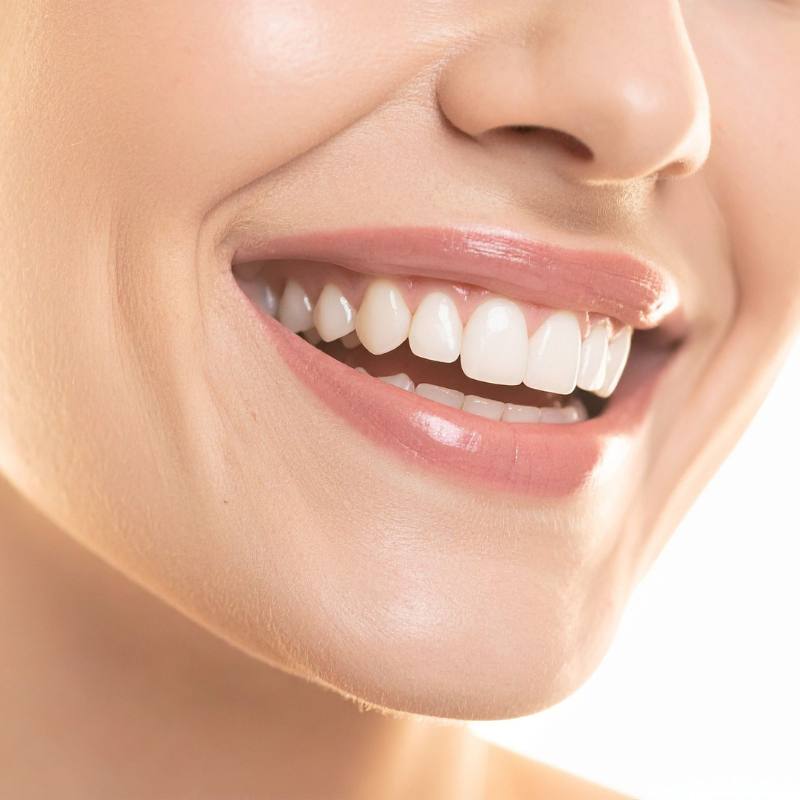 A woman showing the mouth area for Dermal fillers to address marionettes lines, down turned corners of the mouth and smokers lines in Colchester at Bespoke Medical Aesthetics